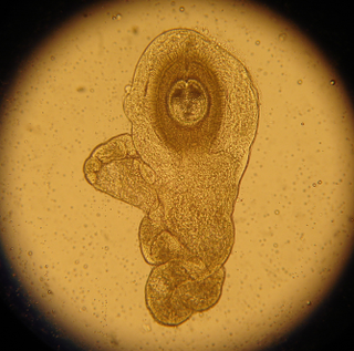 Illustration for article titled Sounds Gross, But Intestinal Worms Can Actually Be Good For You